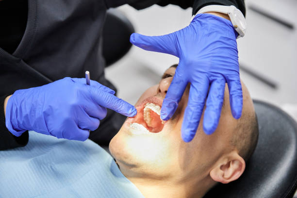 Best Emergency Dentist for Lost Fillings or Crowns in Orem, UT
